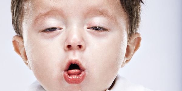 Сильный кашель у ребенка