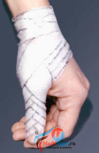 Техника наложения колосовидной повязки на палец